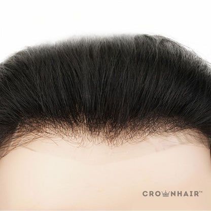 FrontPro – Frontal Prosthesis for a Natural Hairline