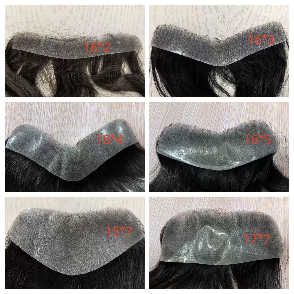 FrontPro – Frontal Prosthesis for a Natural Hairline